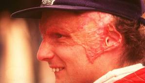 Lauda zog sich schwere Verbrennungen zu, gravierend waren aber vor allem seine Lungenschäden durch das Einatmen von Rauchgas. Doch Lauda erholte sich und gab nur 42 Tage nach dem Unfall sein Comeback. Er wurde noch 2-mal Weltmeister.